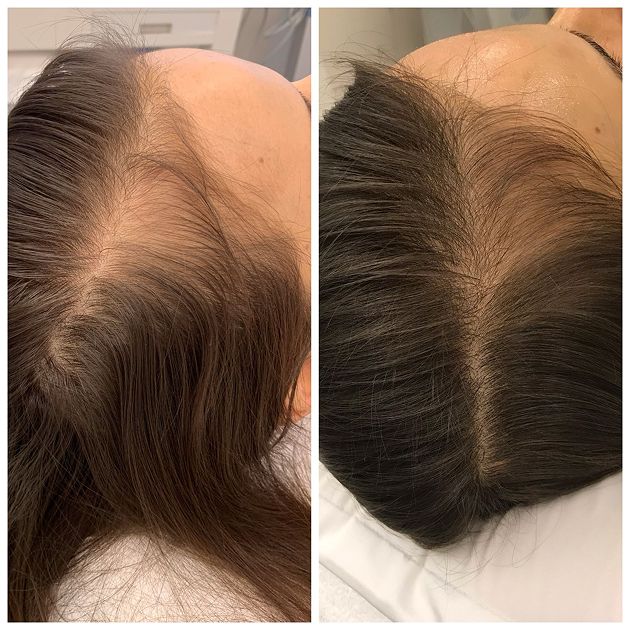 antes-depois-01