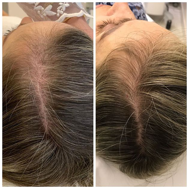 antes-depois-02